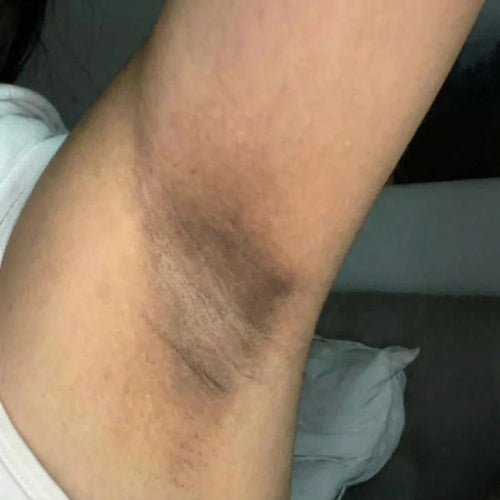 Step 1 — Spray on dry skin