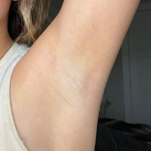 Step 2 — Watch it peel